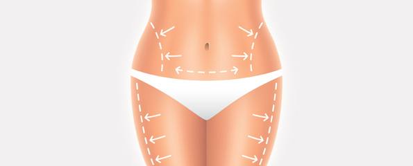 Everything About Liposuction Surgery