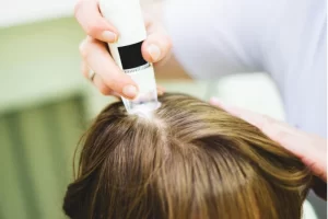 Scalp Treatments in Singapore to achieve your dream hair