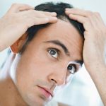 Hair Transplant Procedure